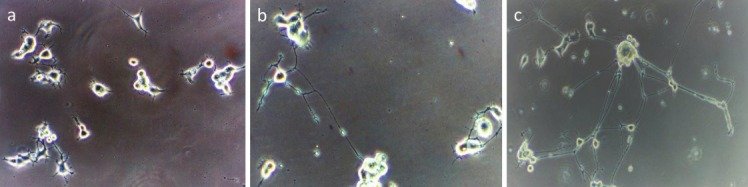 Neuronal Health – Can Culinary and Medicinal Mushrooms Help?
